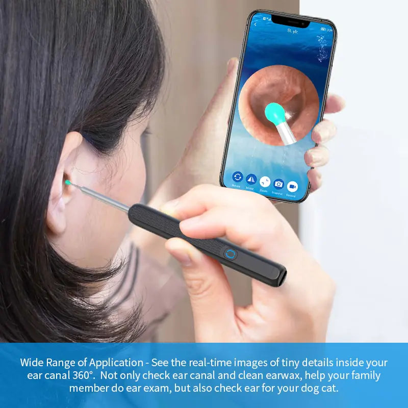 Smart Visual Ear Cleaner Fair Prices Online