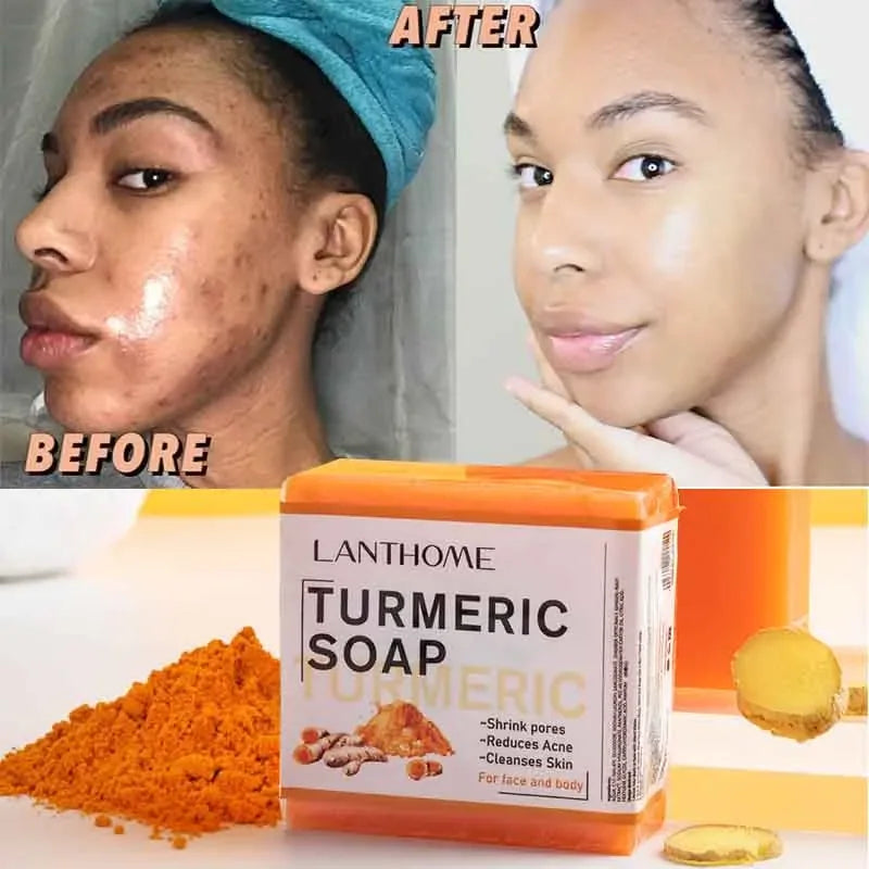 Turmeric Soap Face Cleansing Anti Acne Fair Prices Online